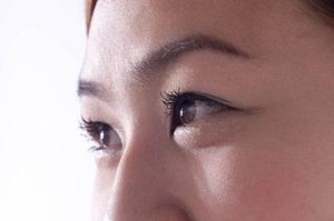 中野在住の方のヒアルロン酸注射利用